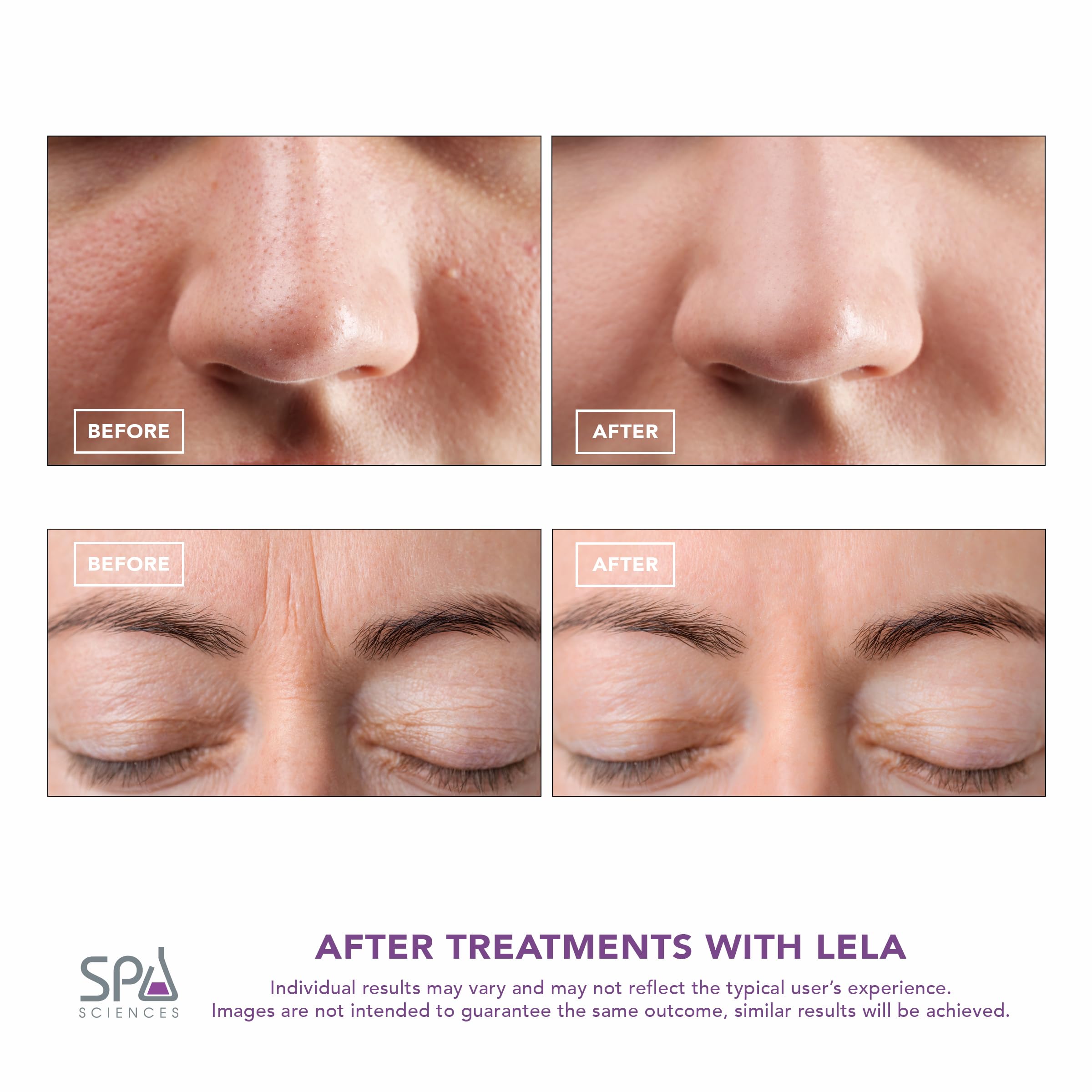 Spa Sciences LELA tratamiento de 4 modos facilita el cuidado completo.