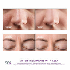 Spa Sciences LELA tratamiento de 4 modos facilita el cuidado completo.
