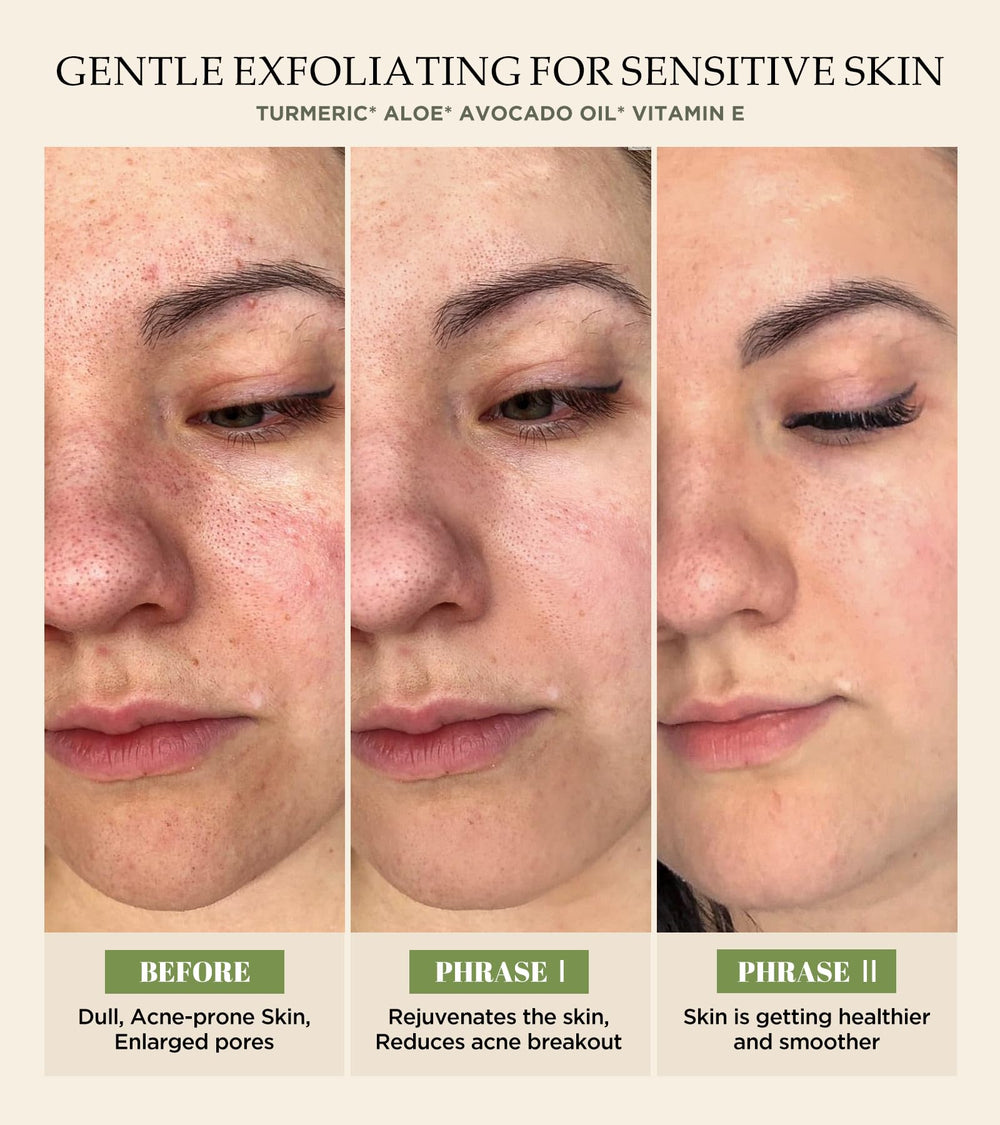 Srripo exfoliante facial, aplicación suave para uso cómodo