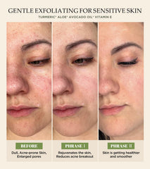 Srripo exfoliante facial, aplicación suave para uso cómodo