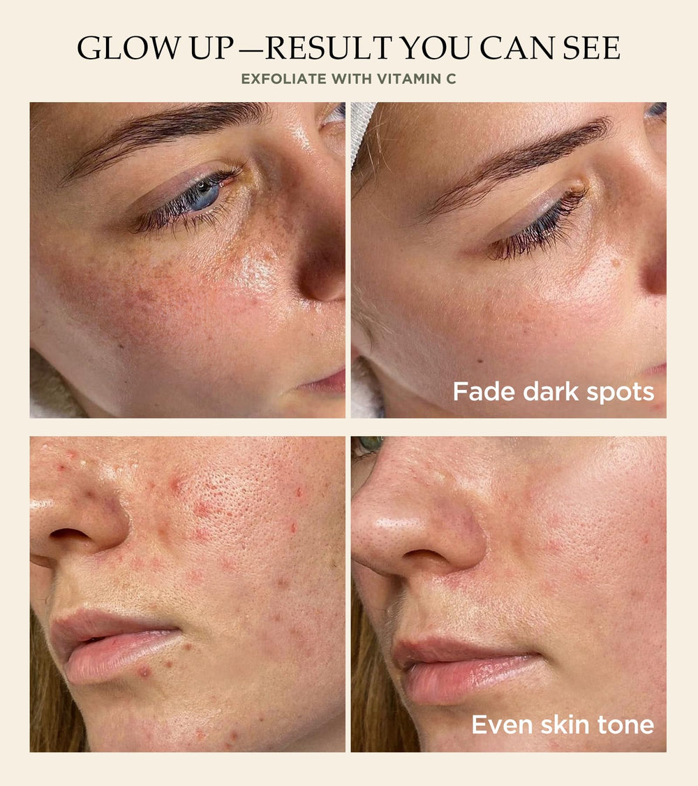 Srripo exfoliante facial, granulos naturales para eliminar impurezas superficiales