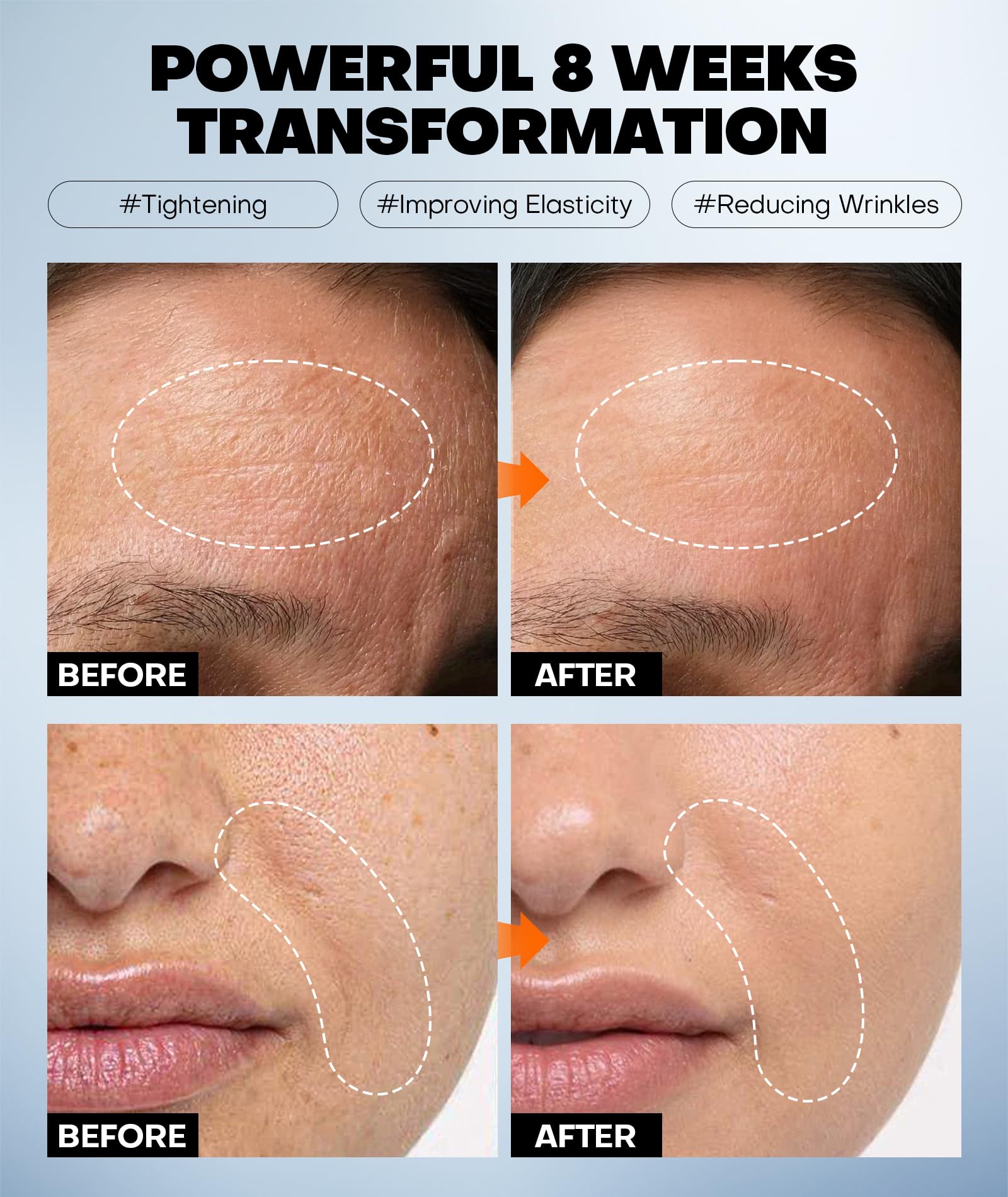 SRRIPO mascarilla antiaging con efecto relleno para contornos sutiles