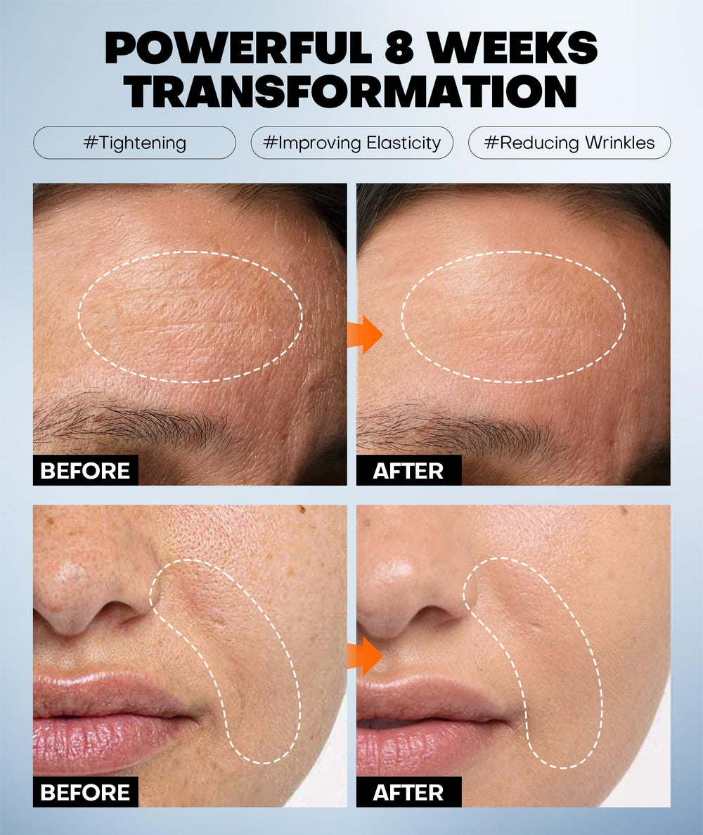 SRRIPO mascarilla antiaging con efecto relleno para contornos sutiles