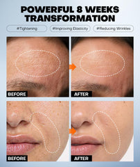 SRRIPO mascarilla antiaging con efecto relleno para contornos sutiles