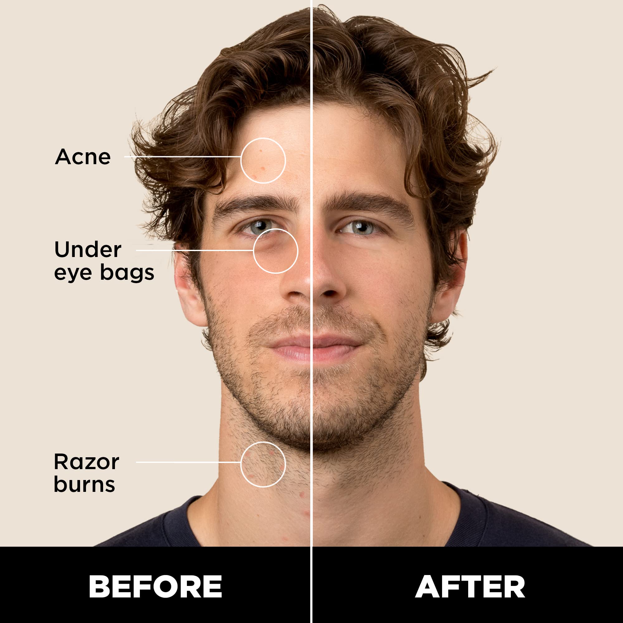 Stryx Concealer Stick being dabbed on the face for natural coverage