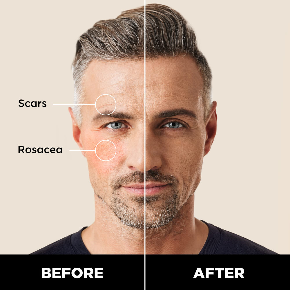 Dab and blend action on the face with Stryx Concealer Tool