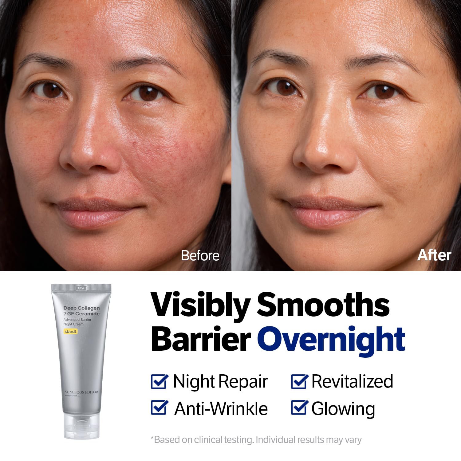 Ceramides 5 et retinol – visuel actifs pour barriere cutanee par SUNGBOON EDITOR