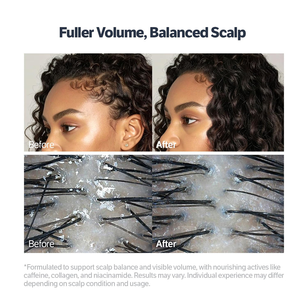 SUNGBOON EDITOR, cafeína y biotina pueden favorecer la microcirculación folicular.