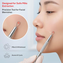 Suvorna extractor de puntos negros para limpieza facial precisa
