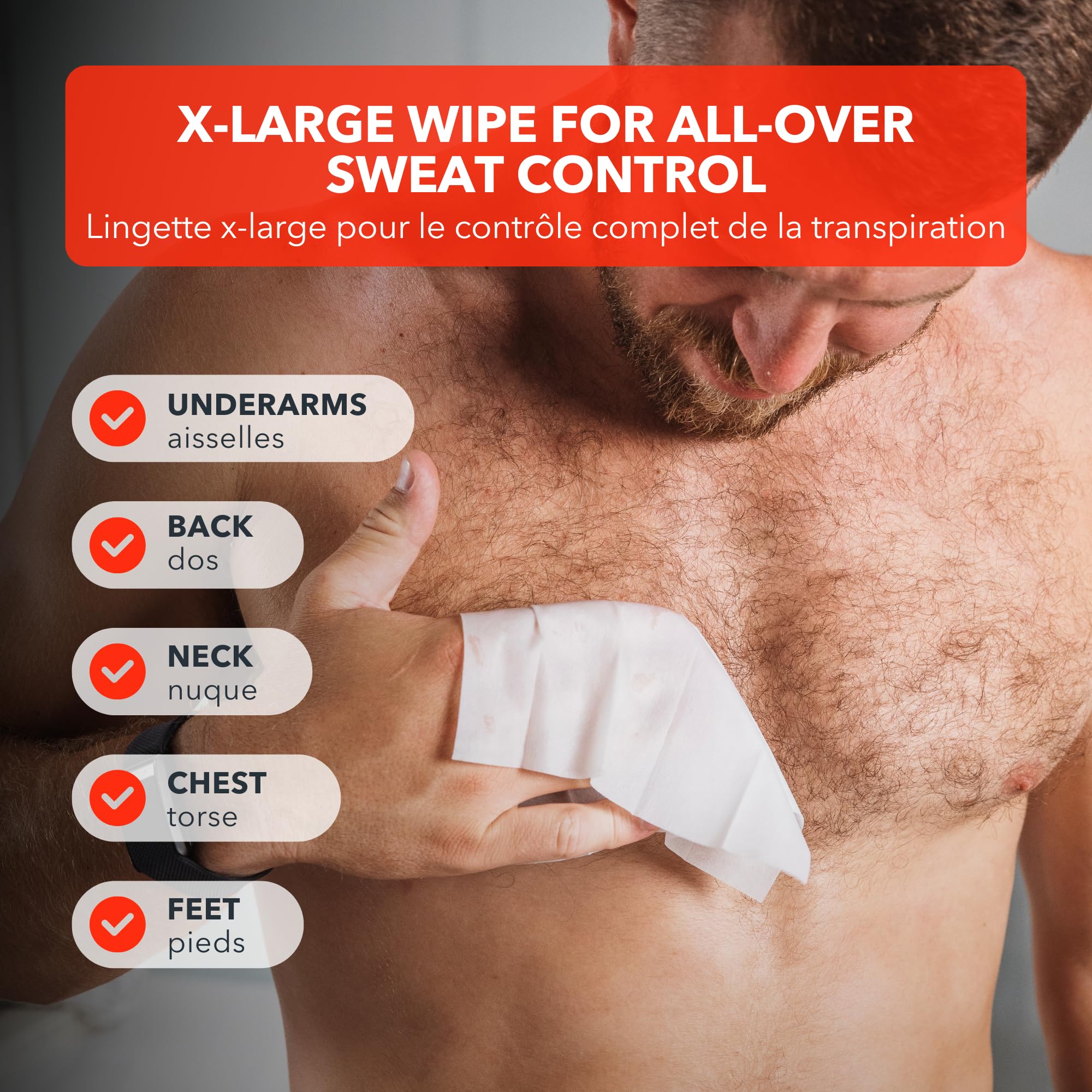 Tratamiento para hiperhidrosis con SweatBlock, reducción de sudoración.