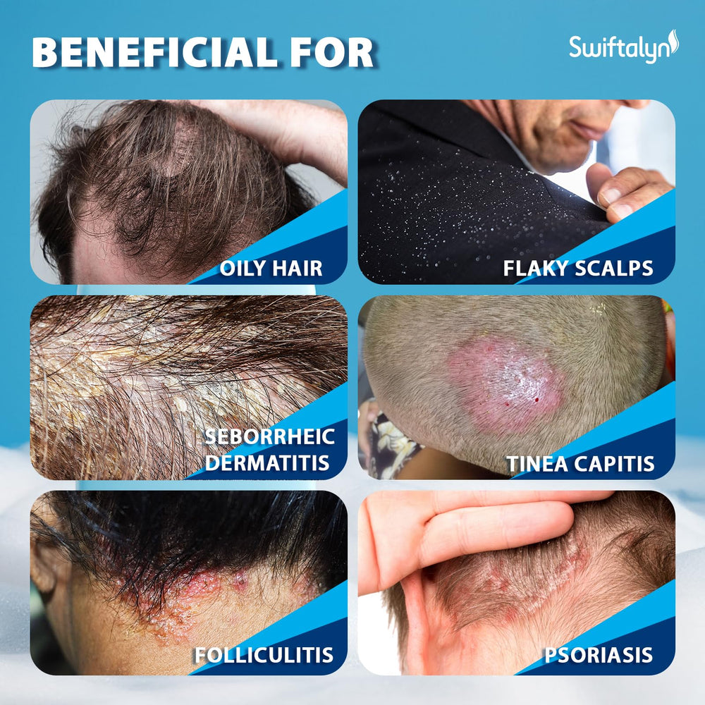 Swiftalyn Acciones-cabello-balance facilita una rutina suave para cabello y cuero cabelludo.