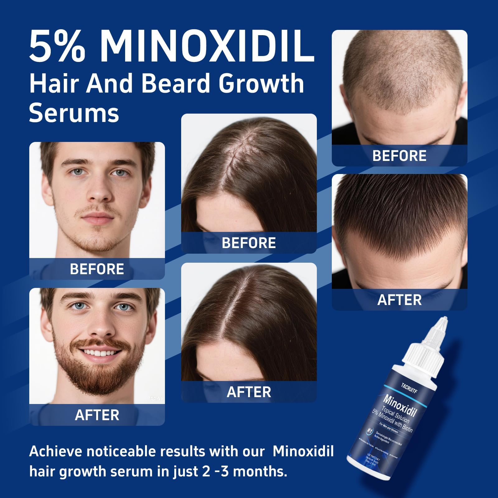 Tapa espiral Tacruitf facilita dosis exacta en el cabello.