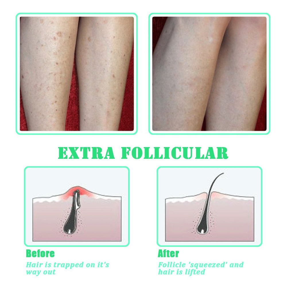 TailaiMei cepillo exfoliante para piernas, axilas y cuello, piel más uniforme y lisa