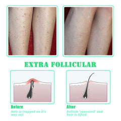 TailaiMei cepillo exfoliante para piernas, axilas y cuello, piel más uniforme y lisa