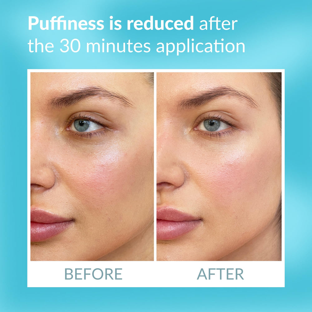 Talika Eye Therapy Patch reducing puffiness around tired eyes