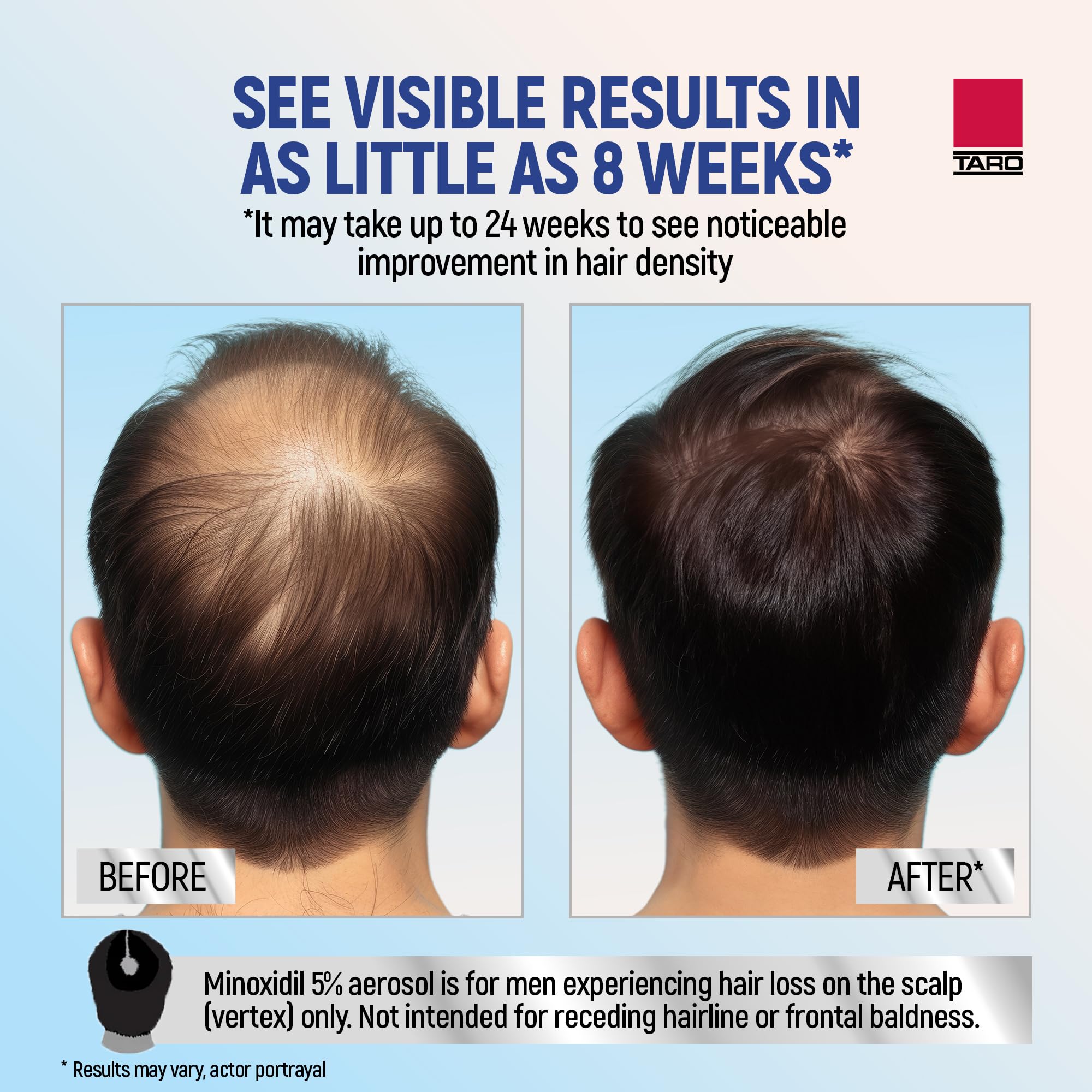 TARO Minoxidil envase frontal, tamaño práctico para un mes.