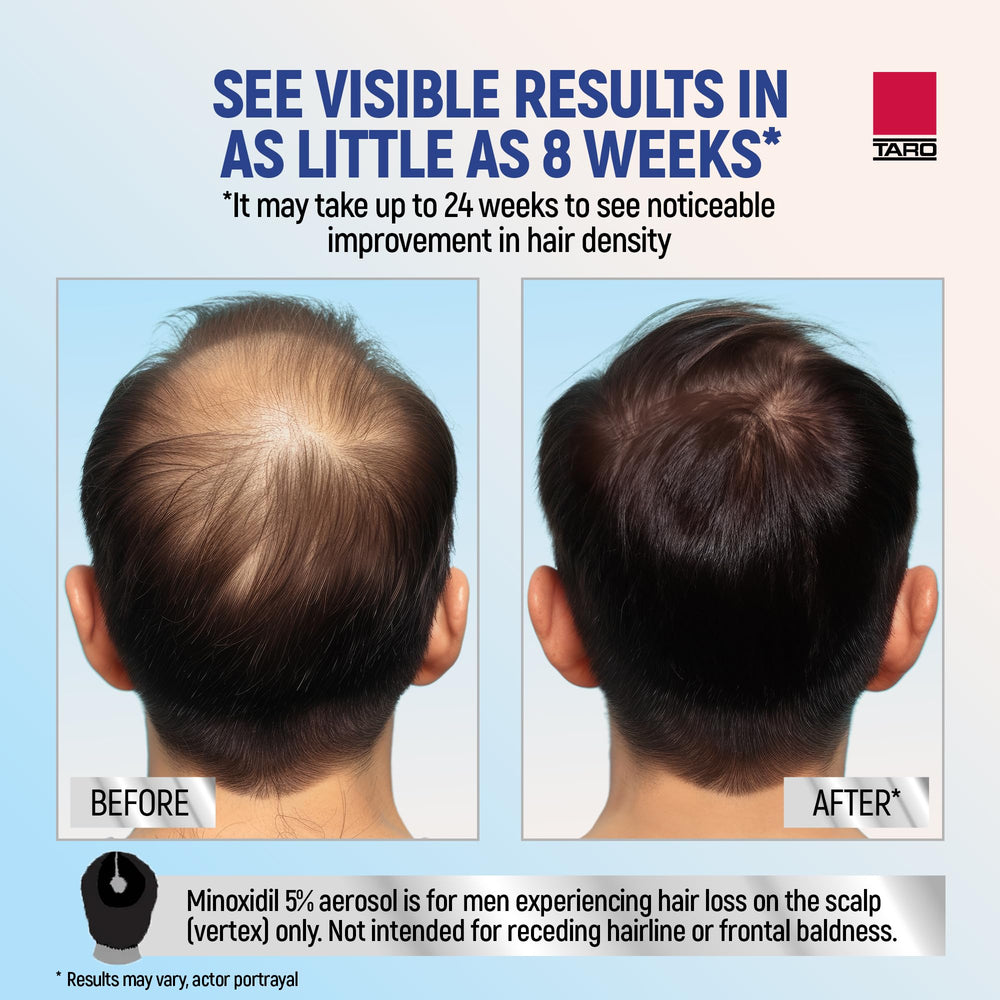 TARO Minoxidil envase frontal, tamaño práctico para un mes.