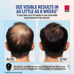 TARO Minoxidil envase frontal, tamaño práctico para un mes.