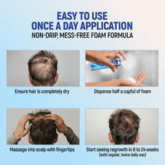 Paquete de TARO Minoxidil con dos unidades para suministro de dos meses.