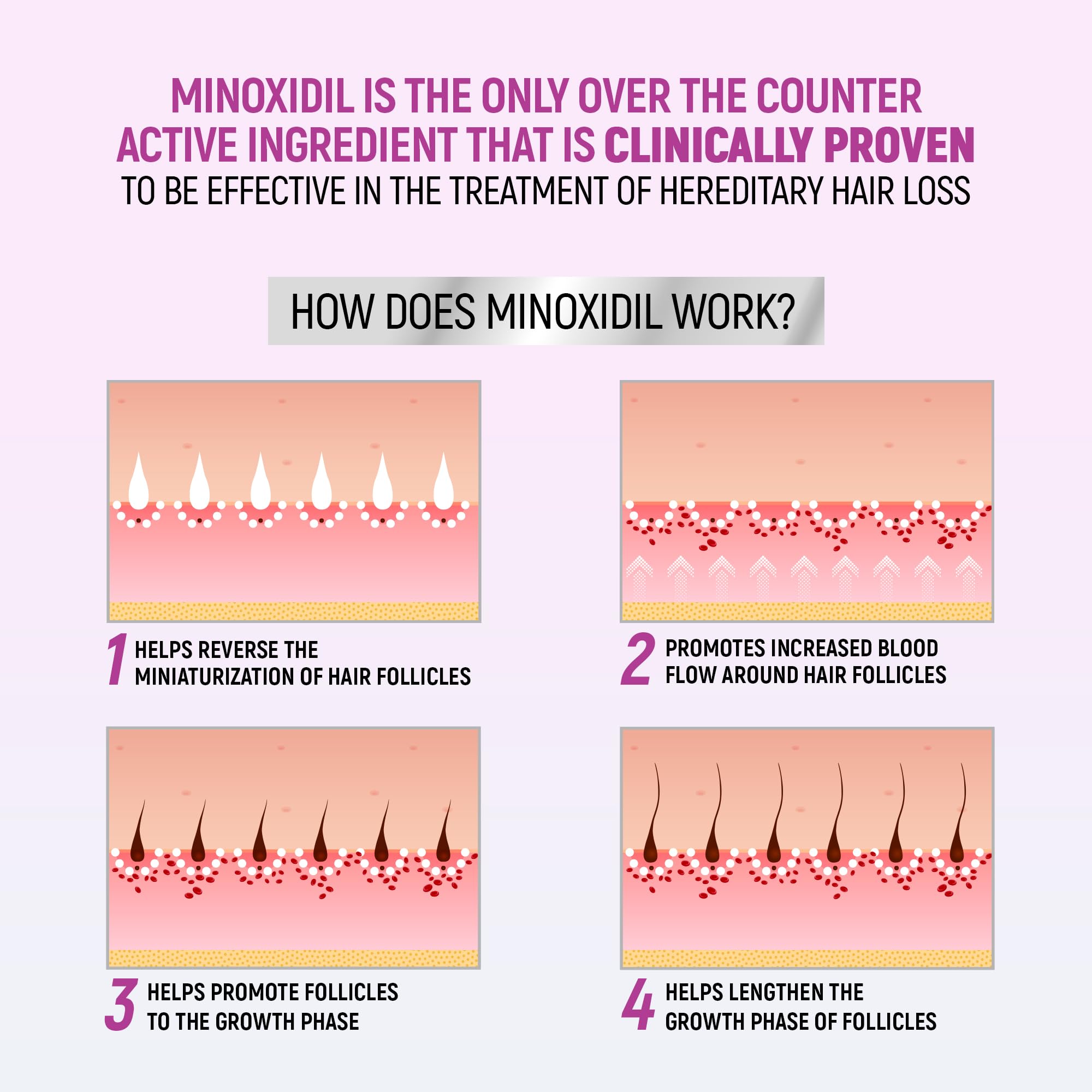 TARO Minoxidil sin fragancia para cuero cabelludo suave