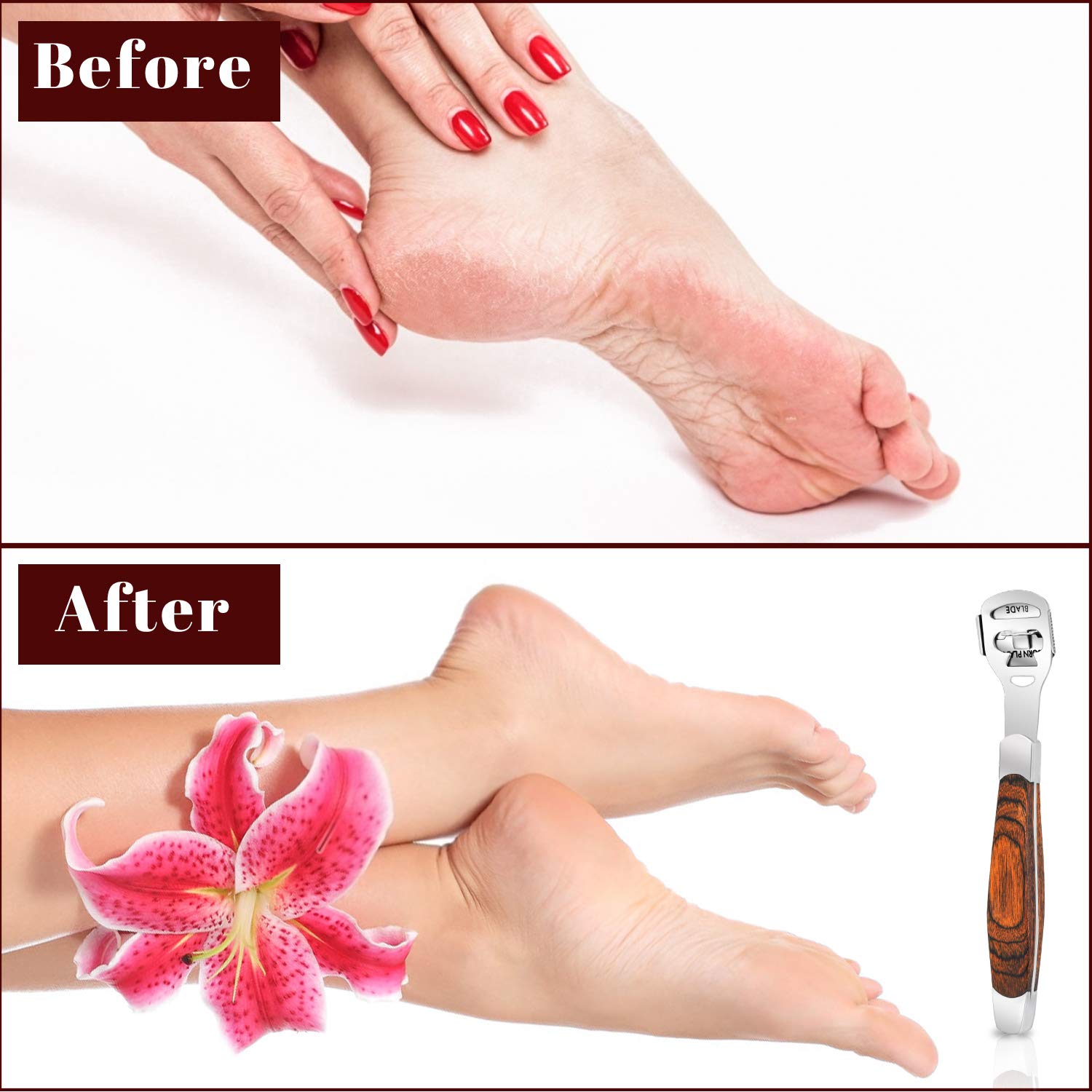 Conjunto completo de pedicura de TCOCOS para uso doméstico.
