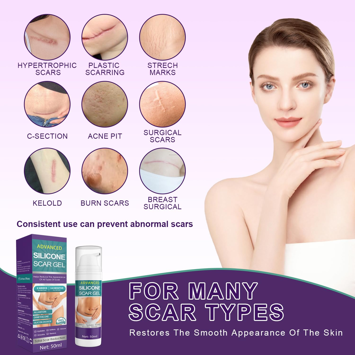 Tearich Crema Silicona para Acne: cuidado suave para cicatrices de acné.