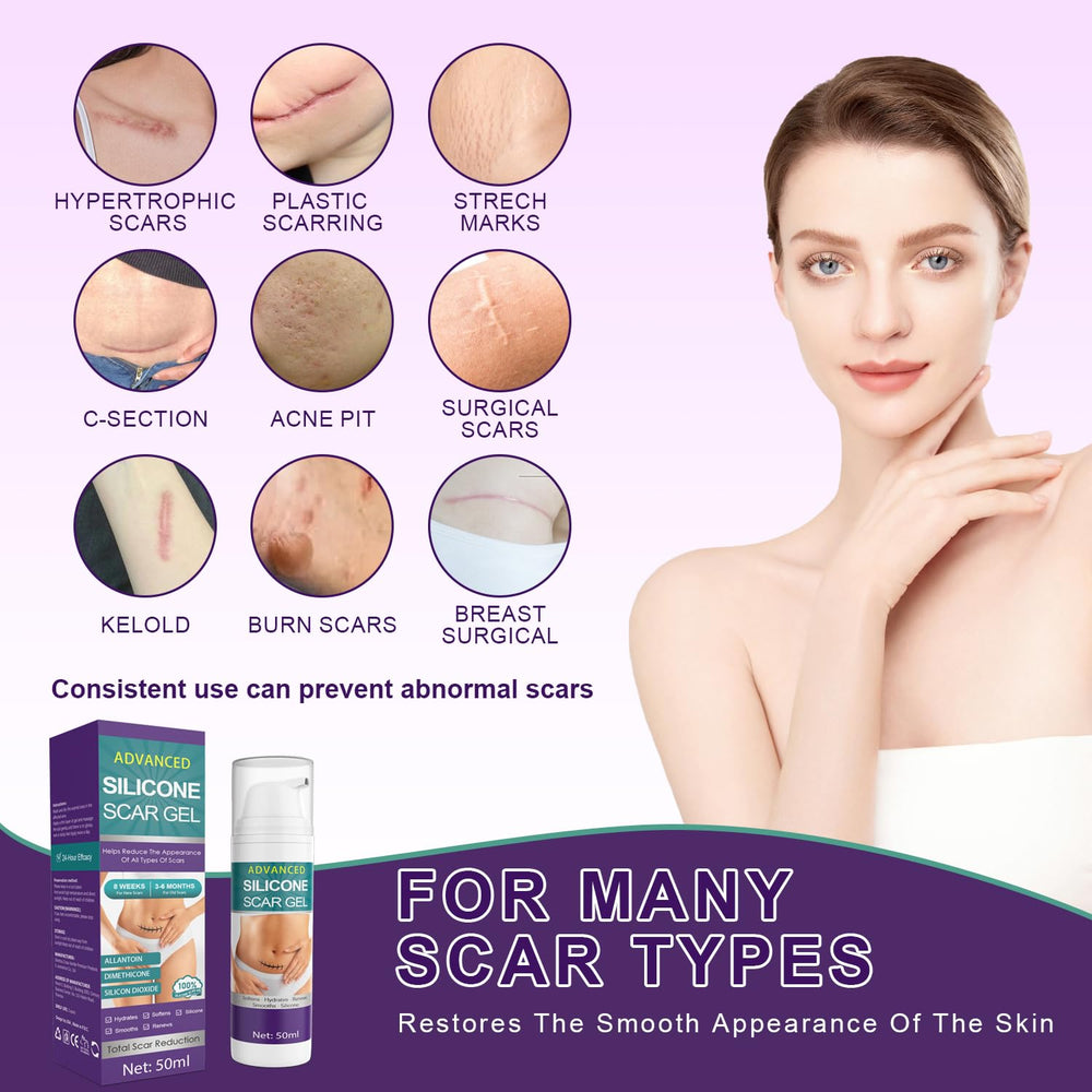 Tearich Crema Silicona para Acne: cuidado suave para cicatrices de acné.