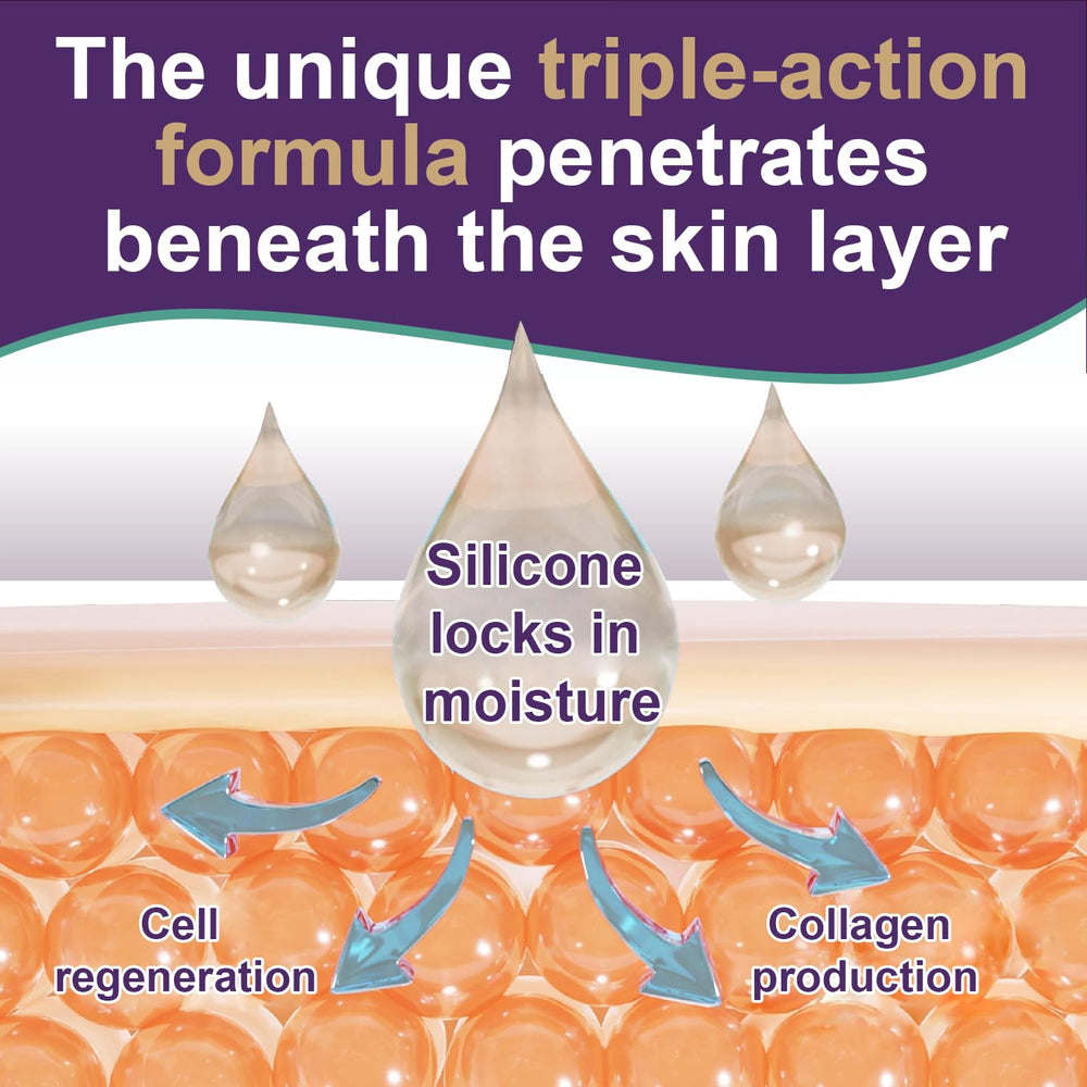 Tearich Gel Silicona para Cicatrices Keloide: favorece la apariencia de cicatrices.