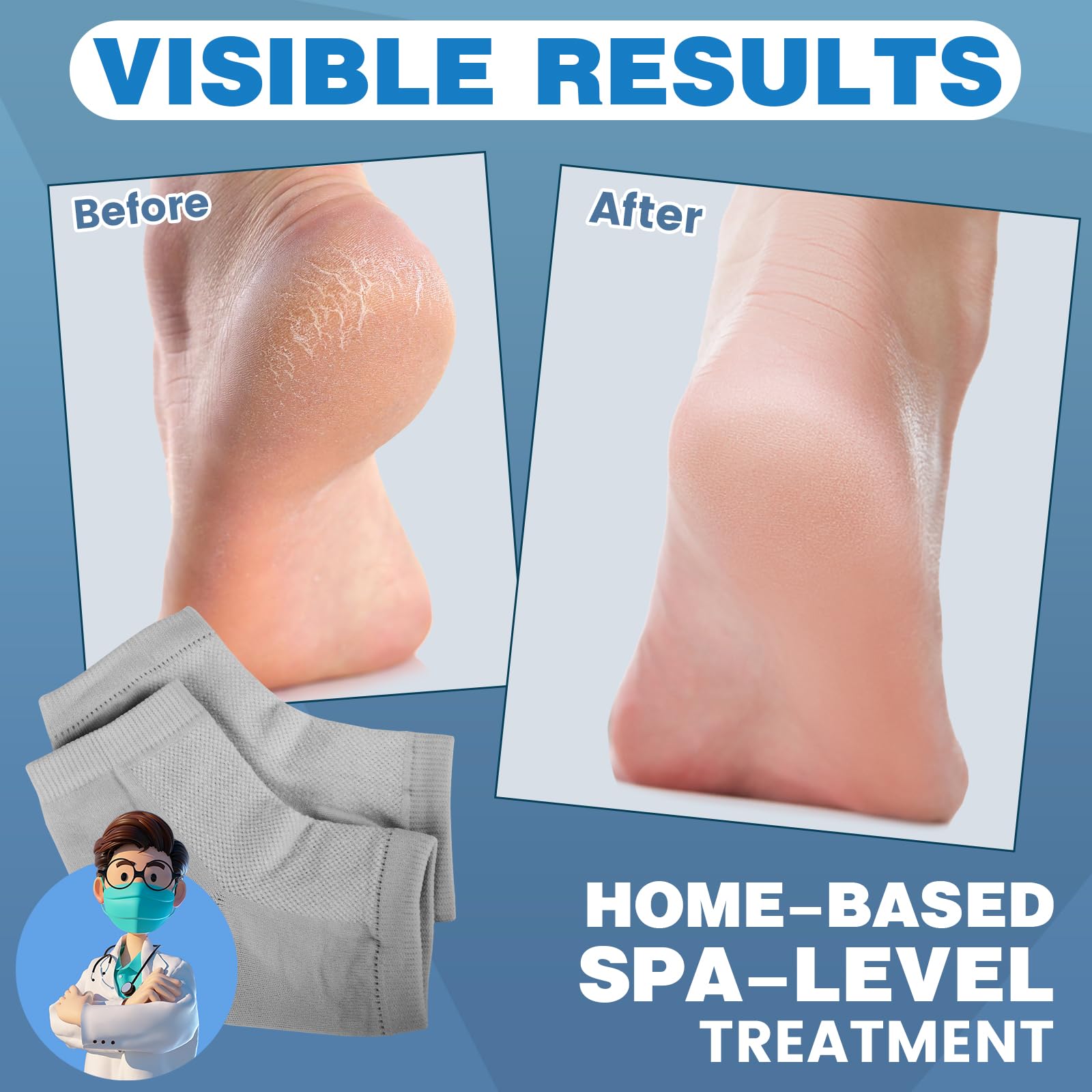 Chaussettes TEAWOO sans orteils, douceur et protection contre les frottements.
