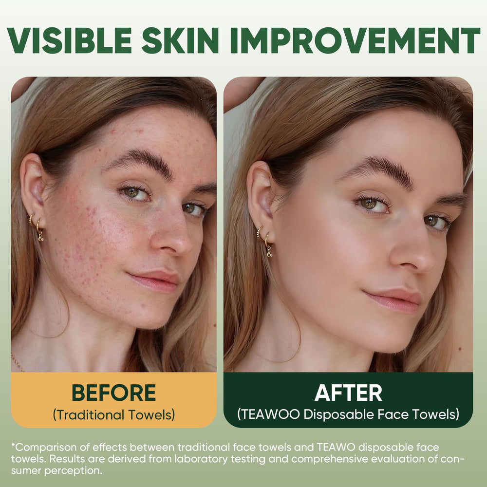 TEAWOO toallas doble cara suaves para maquillaje y cuidado facial diario.