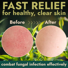 Terramed Just Think Comfort exfoliante corporal con aloe vera para hidratación suave.