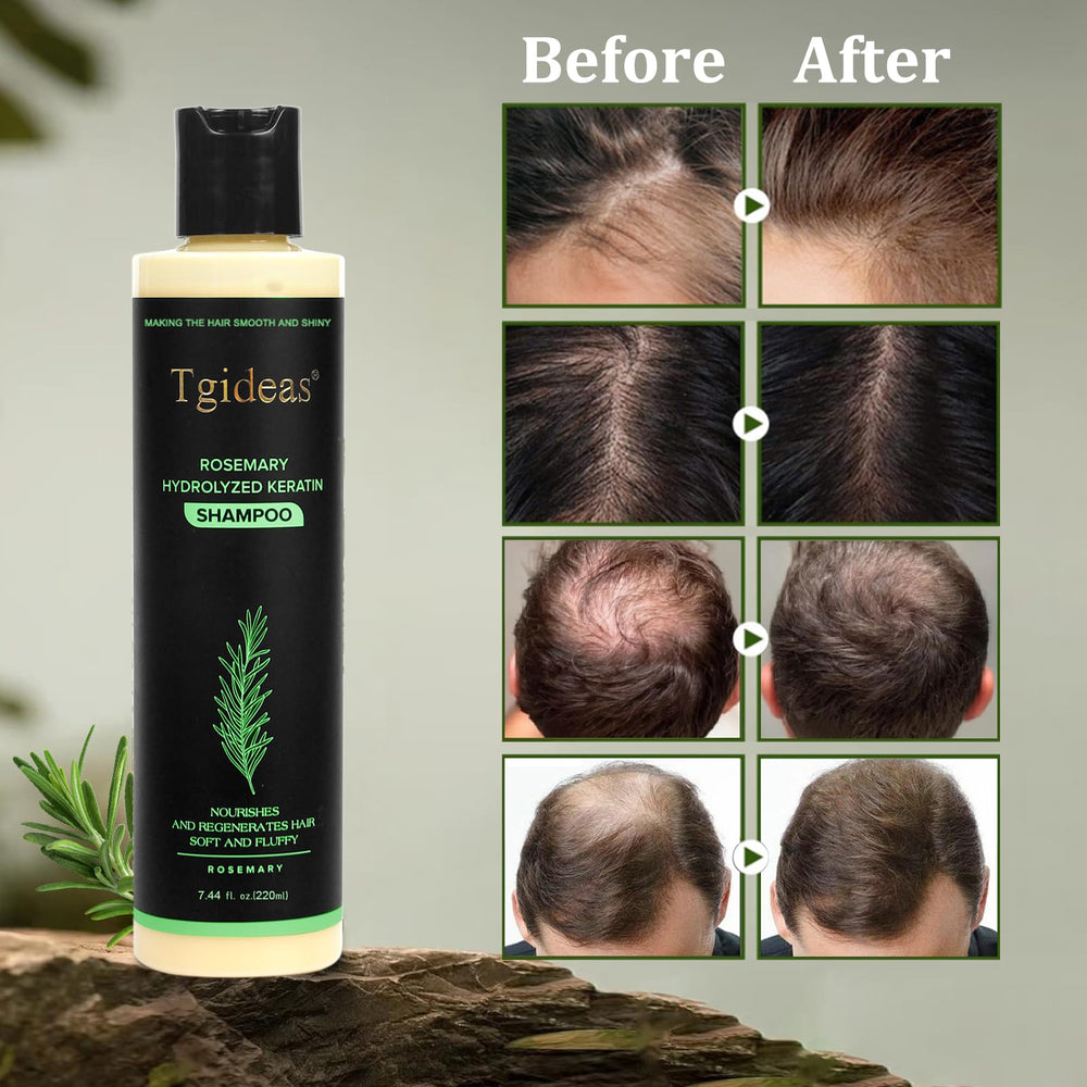 Tgideas Champú Romero con ingredientes naturales nutre y revitaliza.