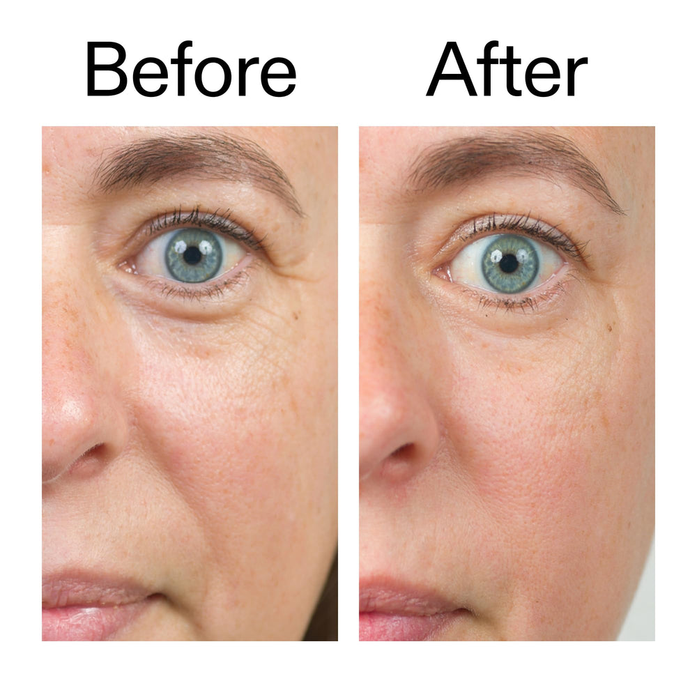 Tests dermatologiques du The INKEY List Bio-Active Ceramide Repairing et Plumping Moisturizer.