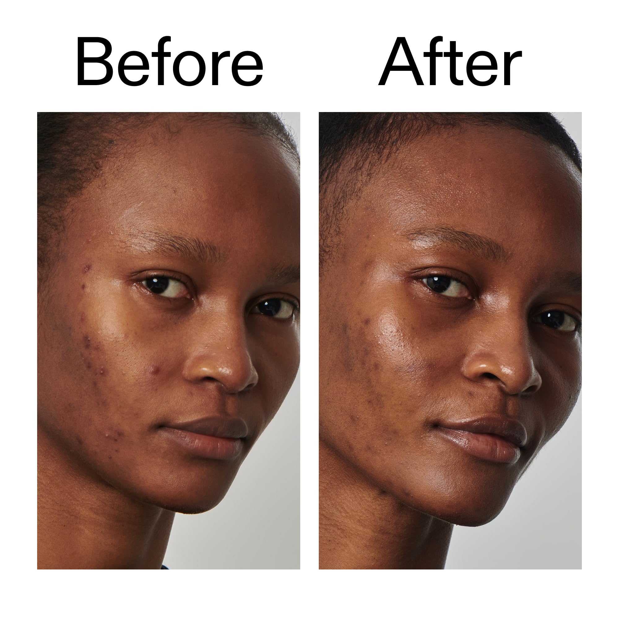 The INKEY List Niacinamida 20% serum, rutina diaria, mejora brillo sin resequedad