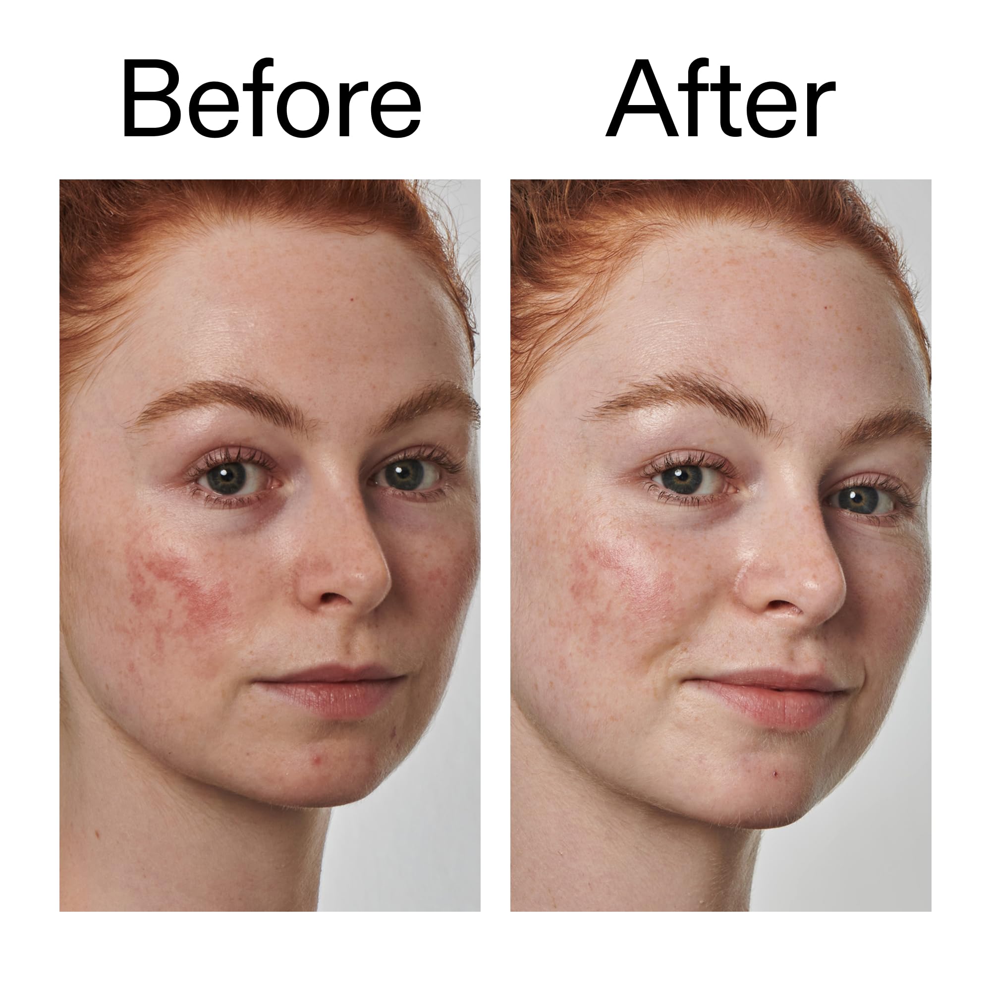 The INKEY List acido-azelaico 10% serum compatible con rutinas de cuidado de la piel.