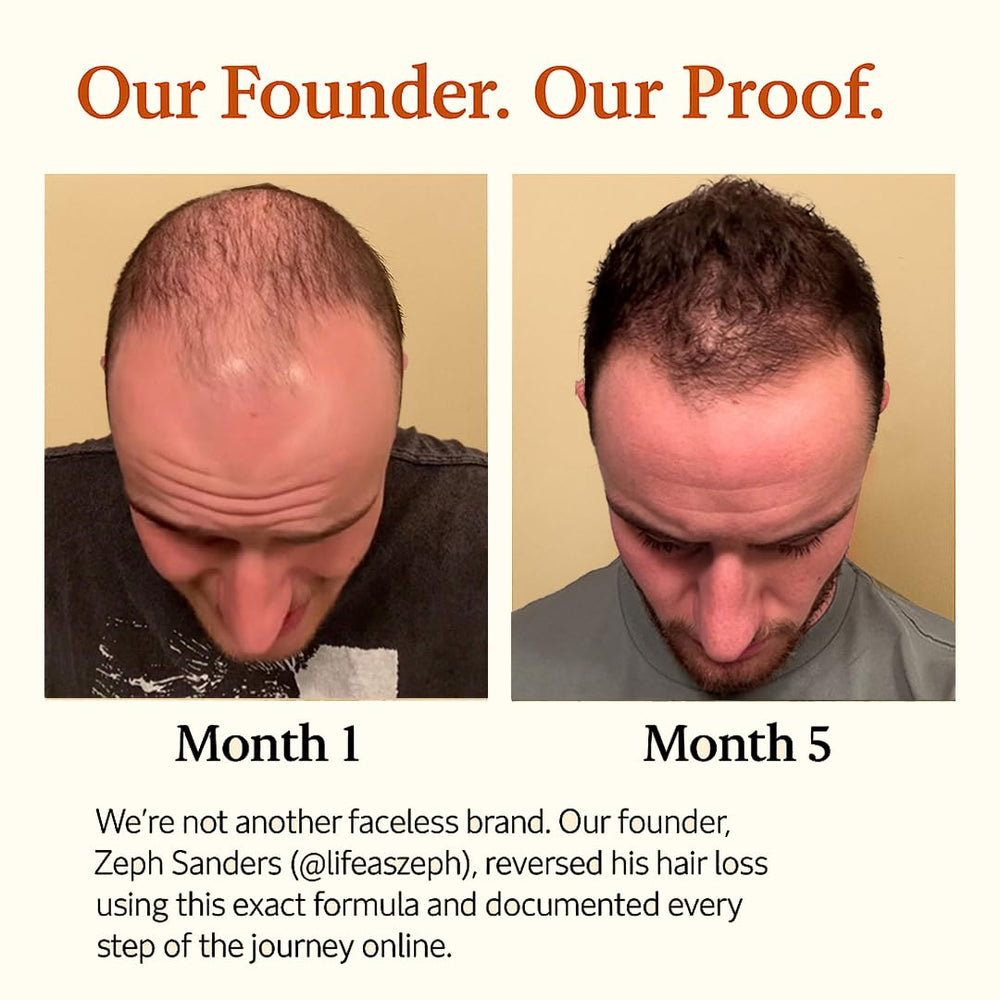 Ingrédients d’origine naturelle The Mane Solution pour nourrir les cheveux.