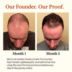 Ingrédients d’origine naturelle The Mane Solution pour nourrir les cheveux.