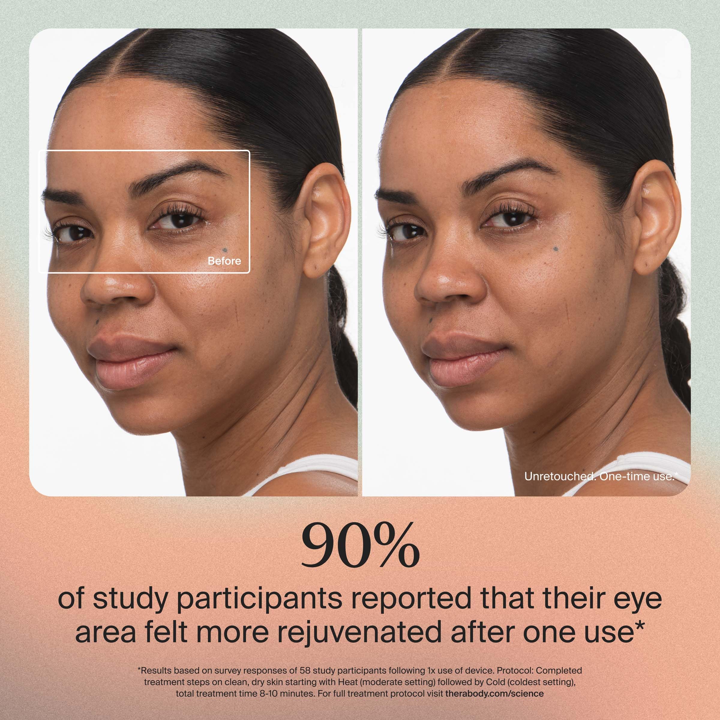 TheraFace Desinflador Facial en modo calor para favorecer la circulación y resplandor.