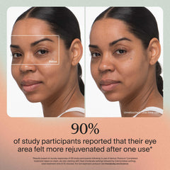 TheraFace Desinflador Facial en modo calor para favorecer la circulación y resplandor.
