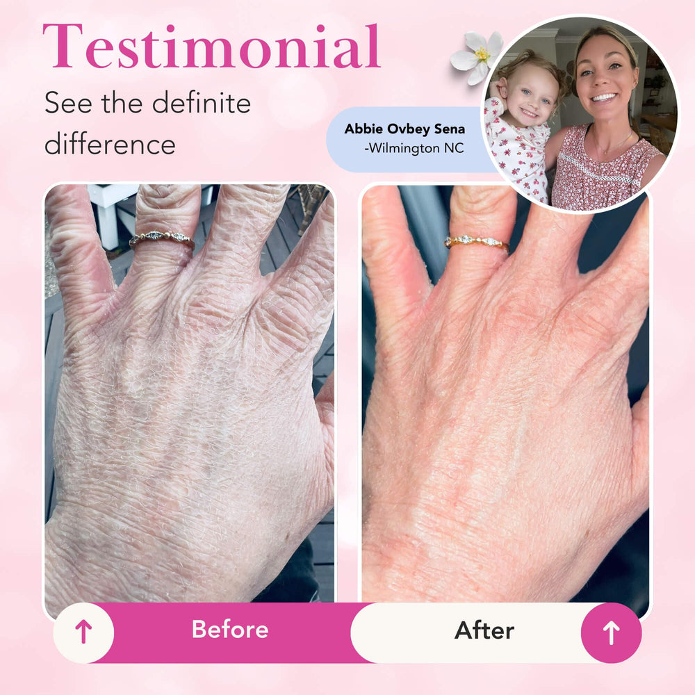 Theraplex Clear Lotion Spray includes jojoba oil for skin nourishment