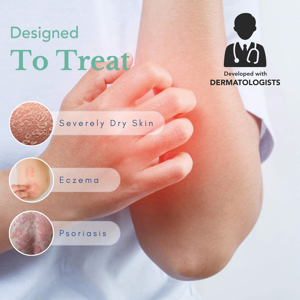 Theraplex Crema Emoliente, aplicación en la mano para suavidad duradera.