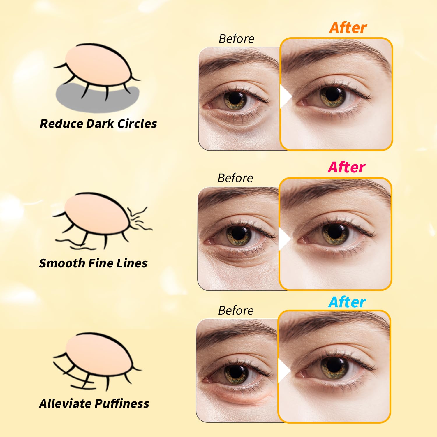 Tibobo parches ojos retinol: renovación suave de la piel alrededor de ojos.