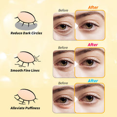 Tibobo parches ojos retinol: renovación suave de la piel alrededor de ojos.