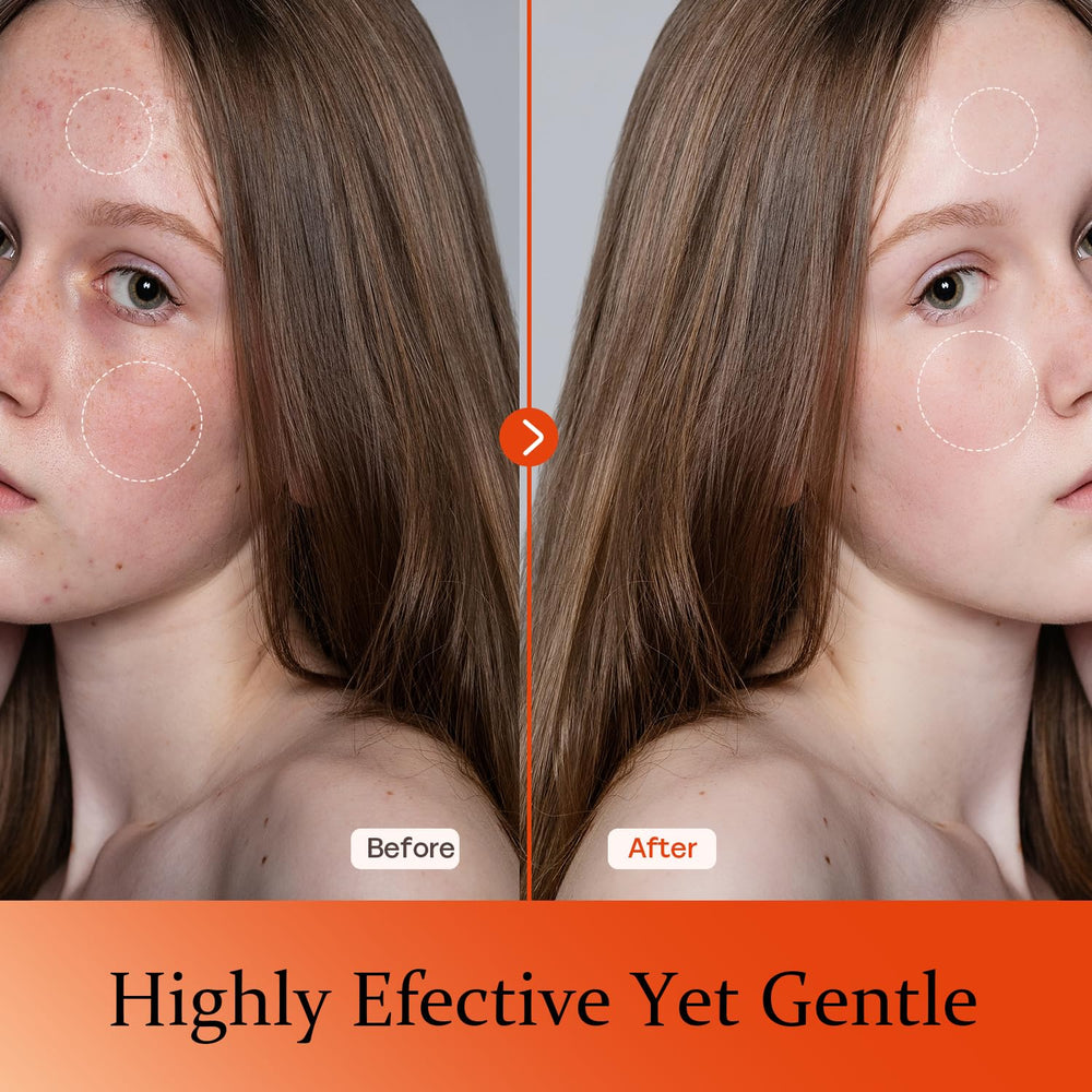 Tinclen Serum Vitamina C: efecto brillo suave para piel cansada