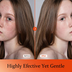 Tinclen Serum Vitamina C: efecto brillo suave para piel cansada