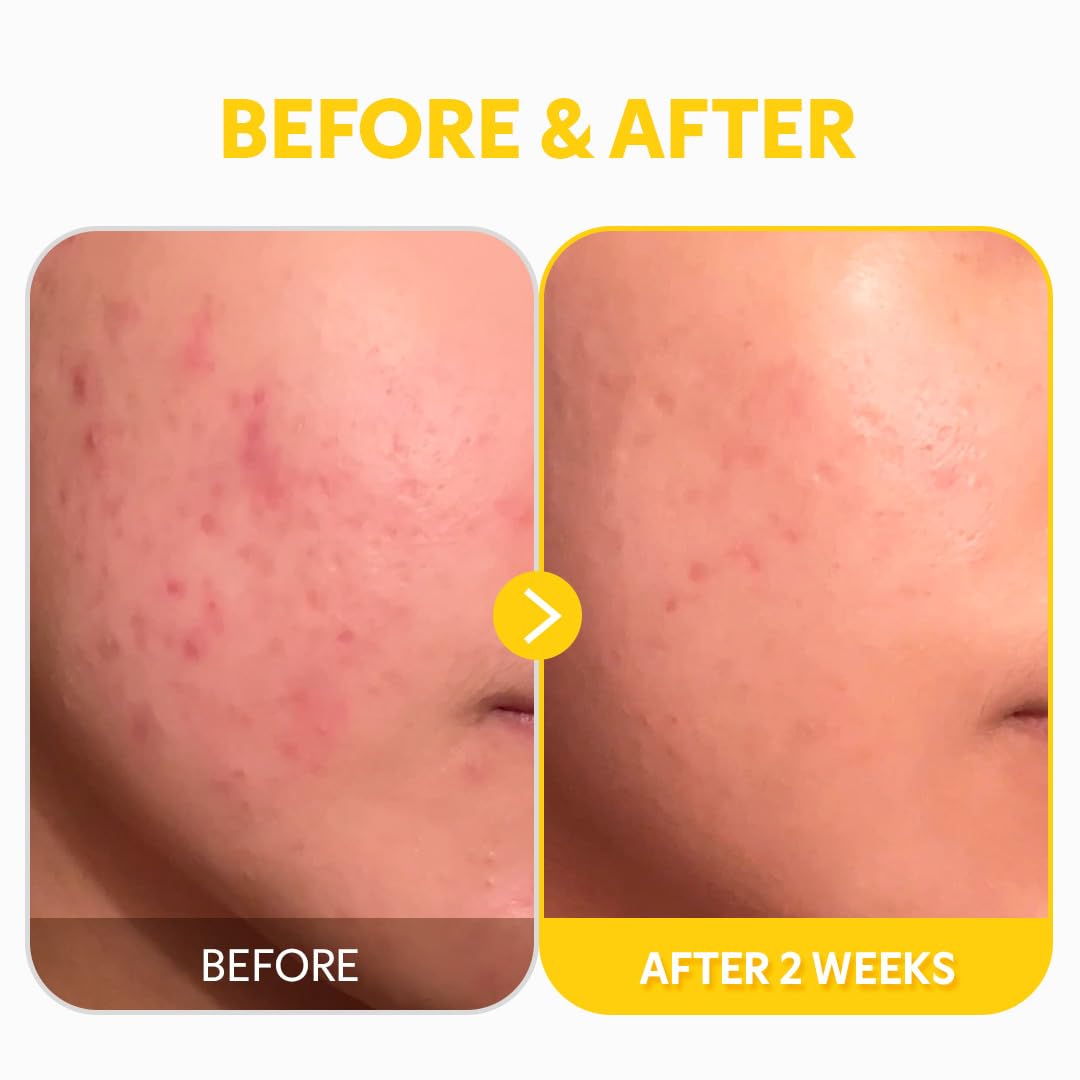 Serum TIRTIR aplicado en la mano durante la rutina.
