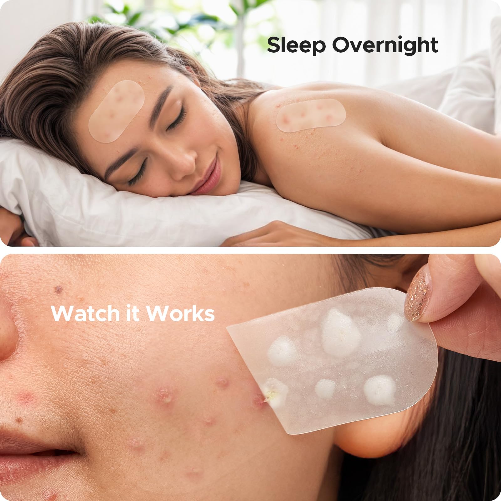 Aplicación fácil del parche TKTK, adherencia suave sin esfuerzo.