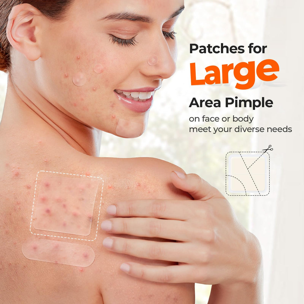 Parches hidrocoloides TKTK 8 mm para imperfecciones pequeñas.