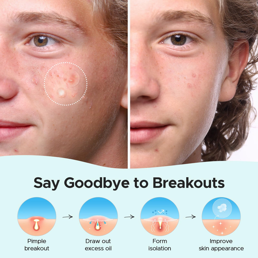 TKTK packaging shows four-size kit for easy selection.