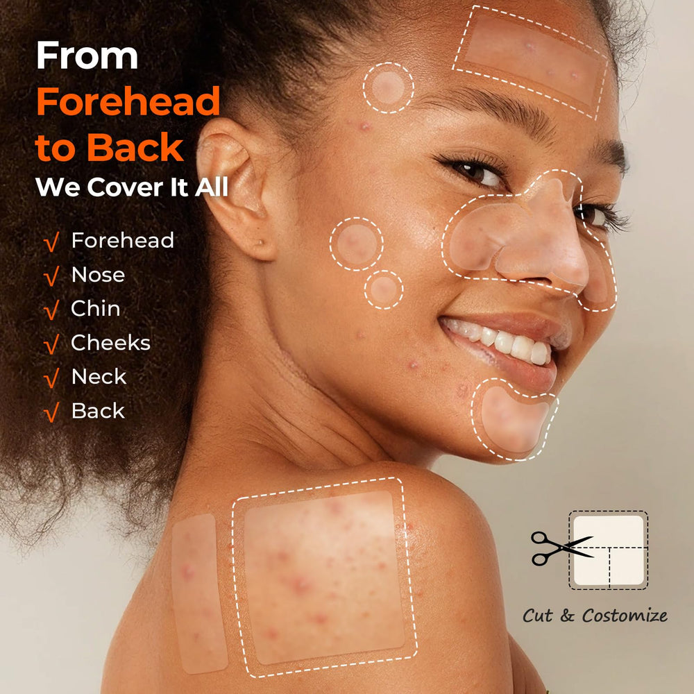 Parche TKTK de 10mm para granos, ofrece cobertura precisa